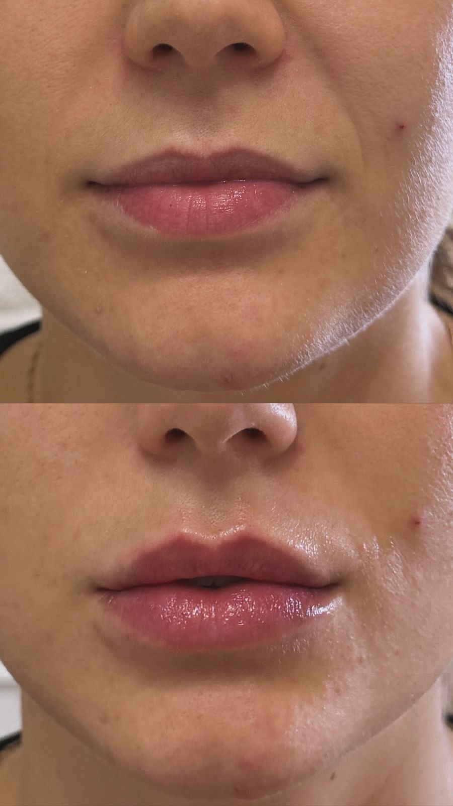 Técnica Russian Lips antes y después