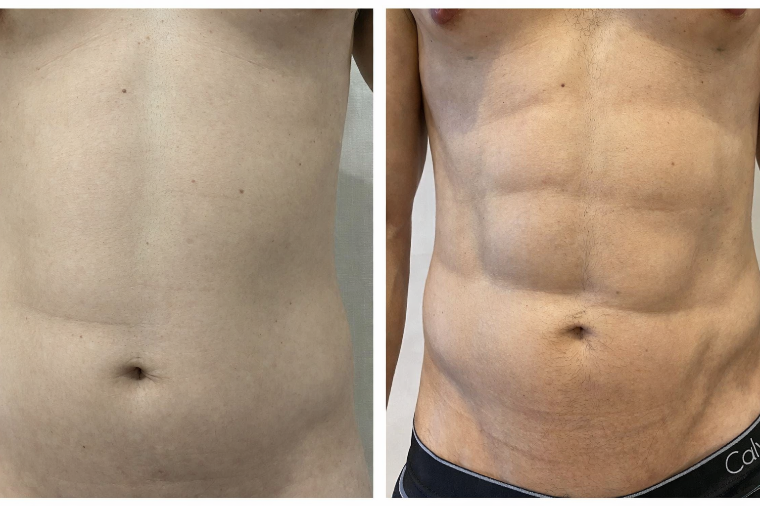 Caso 2 Antes y Después