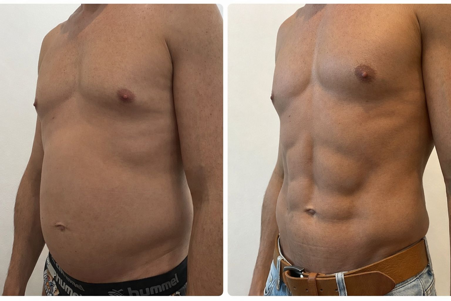 Caso 2 Antes y Después